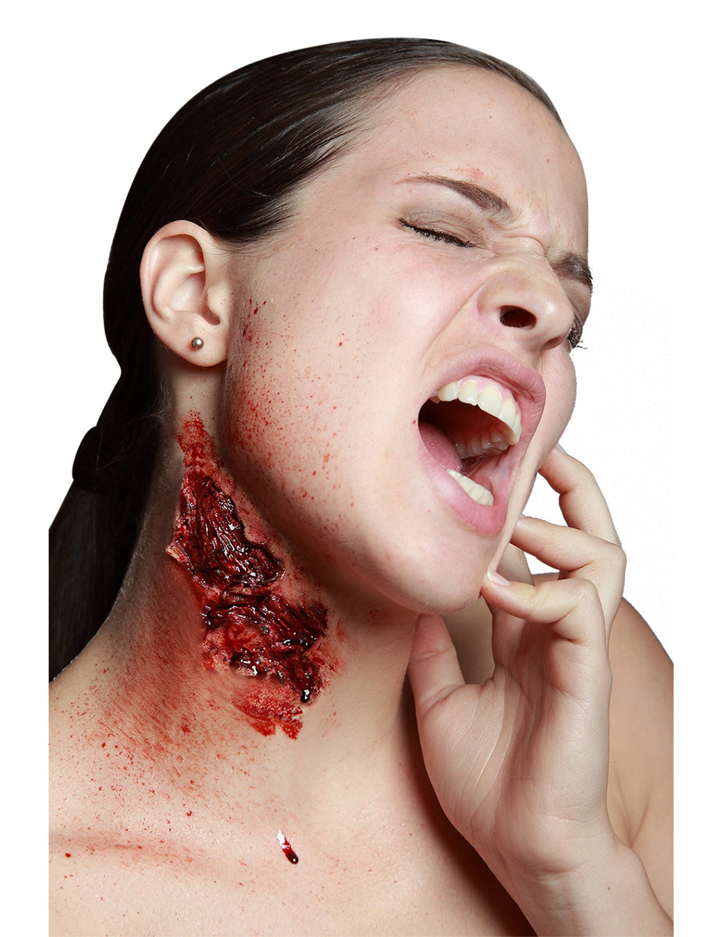 Fausse morsure profonde