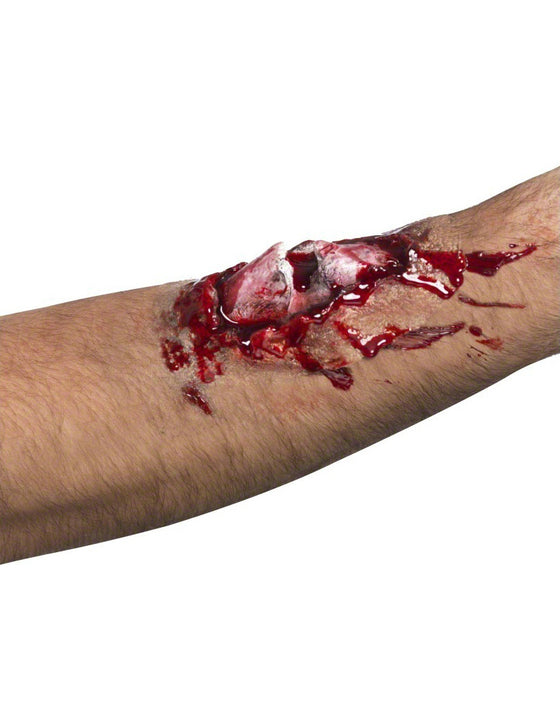 Fausse blessure os cassé